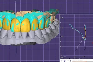 iLike Dental Clinic คลีนิกทันตกรรมไอไลค์ ทำฟัน จัดฟัน รากเทียม พัทยา image