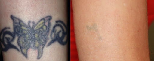 Explore easy flash tattoo ideas, creative tattoo ideas in Anaheim, available at Neoderma