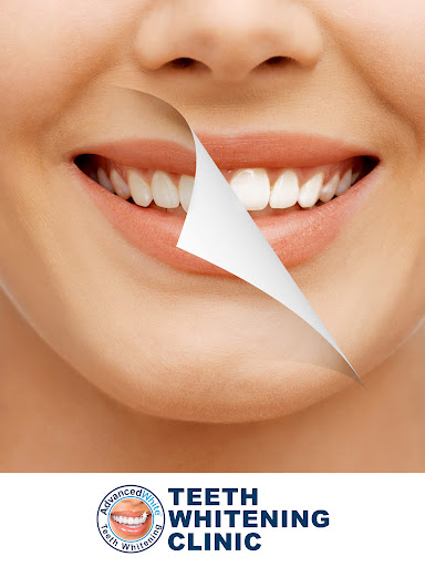 Mississauga Teeth Whitening Clinic