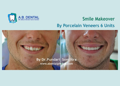 AB Dental Clinic Phuket :Dentist