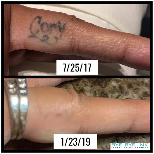 Explore grave tattoo ideas, creative tattoo ideas in Middle Village, available at Bye Bye Ink Laser Tattoo Removal