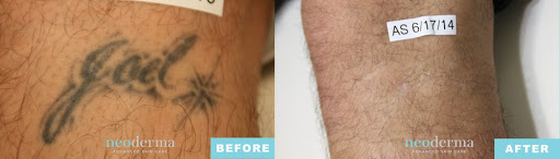 Explore hand tattoo ideas woman, creative tattoo ideas in Anaheim, available at Neoderma