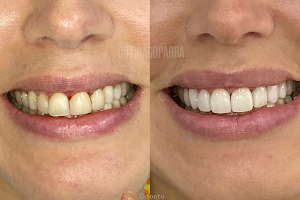 Implante Dentário - ODONTO PARRA image