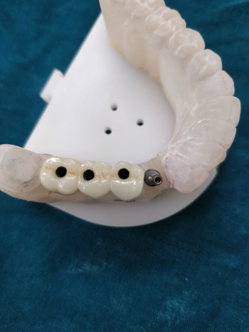 Dr Joglekars Dental Solutions - Dr Joglekars Dental Solutions