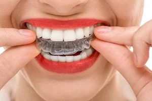 Dr. Luis Ernani Gois Filho | Implante & Estética Dental. image