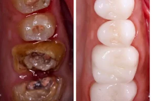 Professors Dental Clinic - عيادة بروفيسورز لزراعة وتجميل الأسنان image