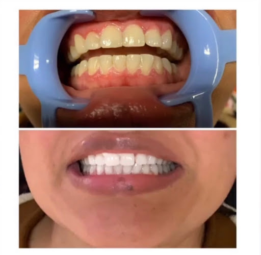 Explore arm flower tattoo ideas, creative tattoo ideas in Fort Bragg, available at Oasis