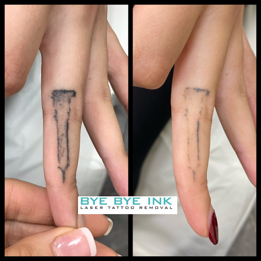Explore mexican eagle tattoo ideas, creative tattoo ideas in Middle Village, available at Bye Bye Ink Laser Tattoo Removal