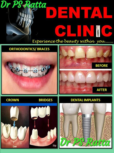 Dr P.S. Ratta, Dental and Implant Clinic (Dr Pavneet) |Dental Clinic| Implants| RCT|Crown & Bridges|