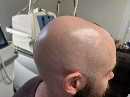 Explore symbol small tattoo ideas, creative tattoo ideas in Raleigh, available at ExcelLase