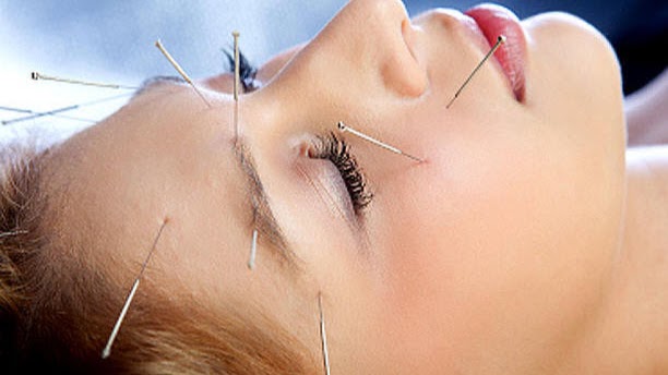 Ying Acupuncture Center