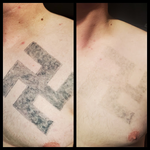 Explore redskins tattoo ideas, creative tattoo ideas in Dubuque, available at Retrospect Tattoo Removal