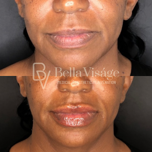 Explore alexander the great tattoo ideas, creative tattoo ideas in Lakeland, available at Bella Visge Medical & Aesthetic Rejuvenation