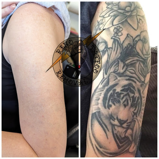 Explore dragon tattoo ideas for ladies, creative tattoo ideas in Reno, available at Reno Tattoo Removal