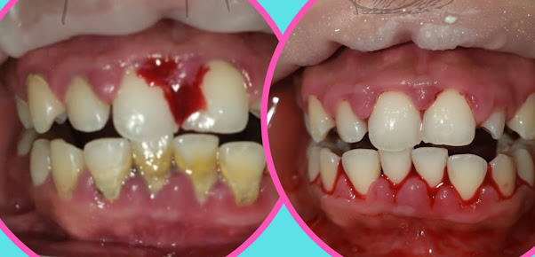 Jezme Orthodontics - Jezme Orthodontics