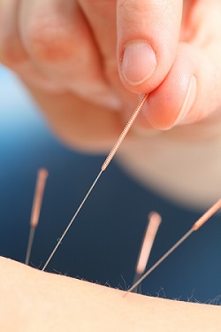 Dr. Joo Acupuncture. Inc (JW Health Care) image