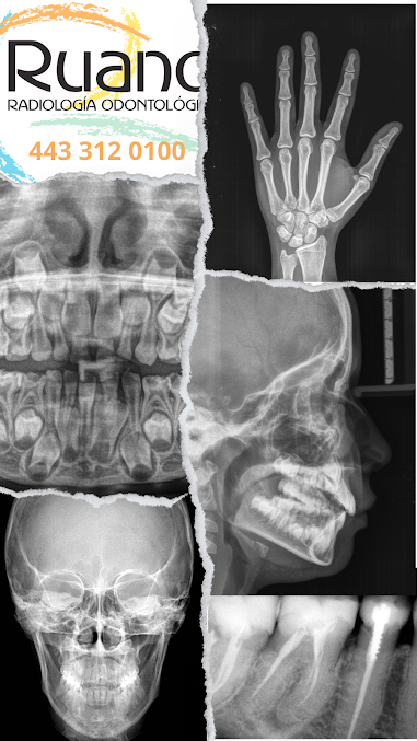 RUANO Servicios Odontológicos - RUANO Servicios Odontológicos