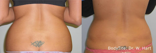 Zormeier Cosmetic Surgery and Longevity Center image