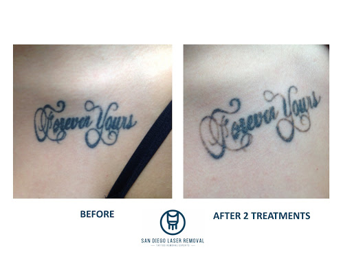 Explore leg tattoo ideas male, creative tattoo ideas in San Diego, available at Removery Tattoo Removal & Fading