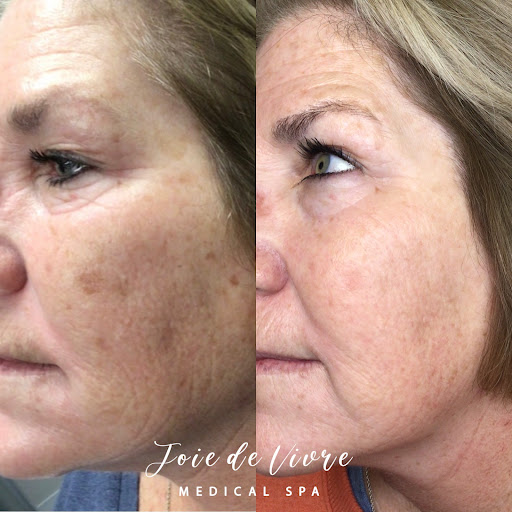 Explore foot tattoo ideas for women, creative tattoo ideas in Canton, available at JDV Med Spa