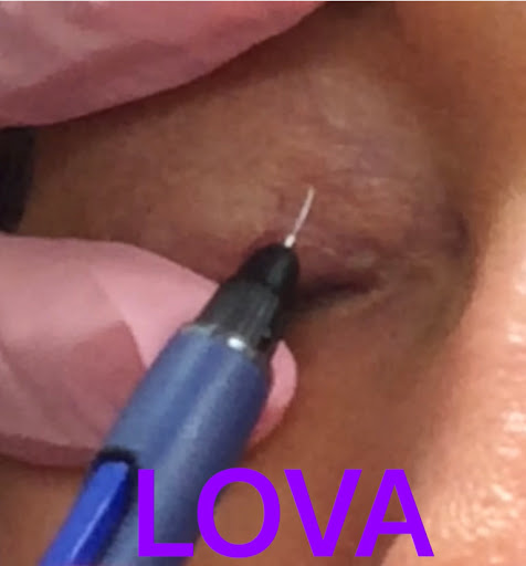 Explore 49ers tattoo ideas, creative tattoo ideas in Lake Oswego, available at Lake Oswego Vein and Aesthetic LOVA