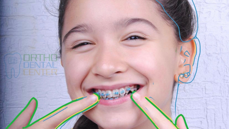 orthodentalcenter