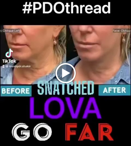 Explore bass guitar tattoo ideas, creative tattoo ideas in Lake Oswego, available at Lake Oswego Vein and Aesthetic LOVA