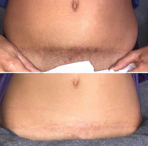 Explore risk taker tattoo ideas, creative tattoo ideas in Santa Cruz, available at Luca Permanent Cosmetics