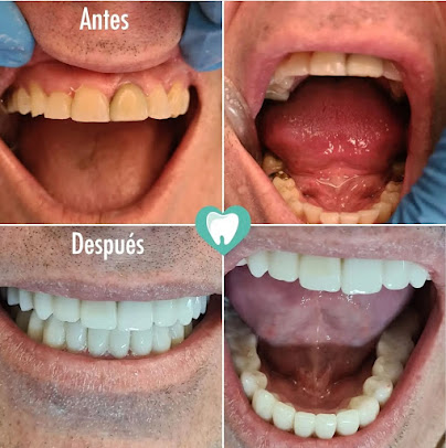 DentalHD Odontologia de Alta Estetica - DentalHD Odontologia de Alta Estetica