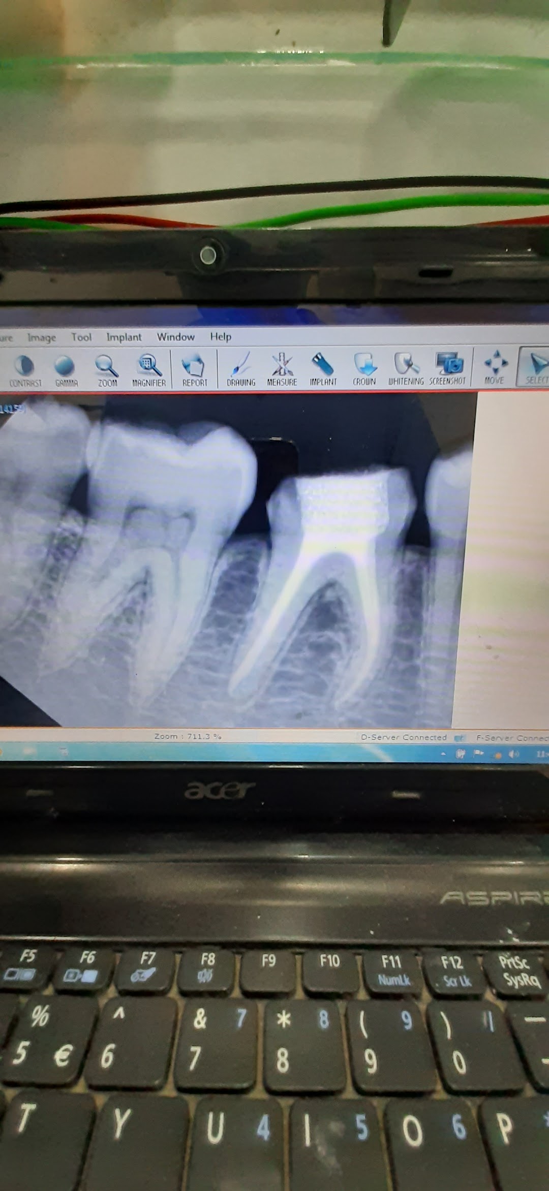 Dental Clinic - Dr.S.K.Khatri