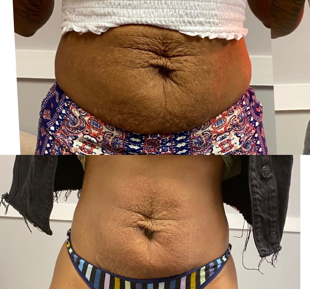 The Beauty In You Spa 27615