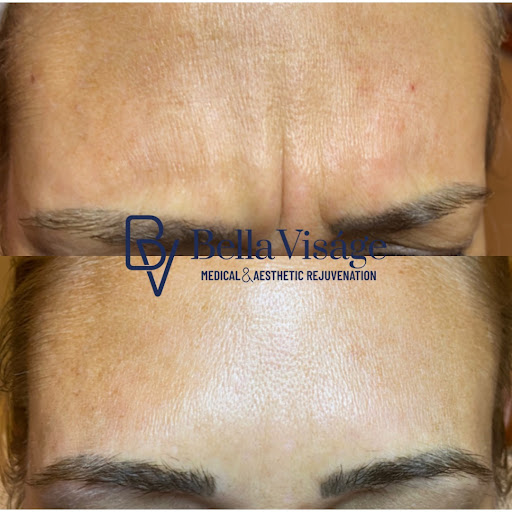 Explore tattoos ideas easy, creative tattoo ideas in Lakeland, available at Bella Visge Medical & Aesthetic Rejuvenation