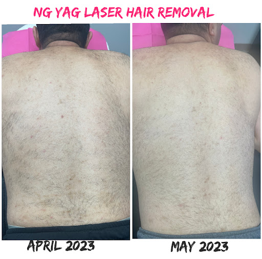 Explore beatles tattoo ideas, creative tattoo ideas in Des Moines, available at Bare Beaute Permanent Hair Removal By Electrolysis, LLC