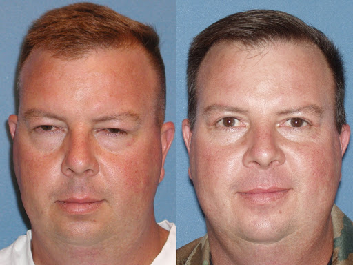 Plastic Surgeon «Arizona Eye Institute & Cosmetic Laser Center», reviews and photos, 19052 N R H Johnson Blvd, Sun City West, AZ 85375, USA