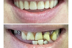 Dentista OralCenter Implantes Dr.Fabio Benedetti e Dra. Marieli Tomasi image