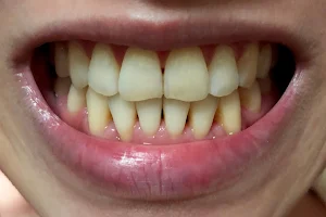 Clarity Smile Dental Centre 快美健矯齒中心 image