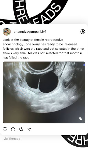 Dr. Amulya Gumpalli - Best IVF & FERTILITY SPECIALIST | Gynecologist | Cosmetic Gynecologist in Hyderabad