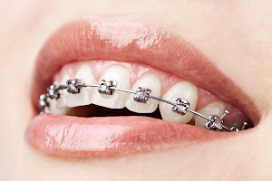 Classics Dental - Panmure Affordable Dentistry