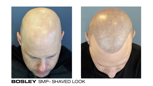 Hair Transplantation Clinic «Bosley Medical - Seattle», reviews and photos, 2505 2nd Ave #715, Seattle, WA 98121, USA