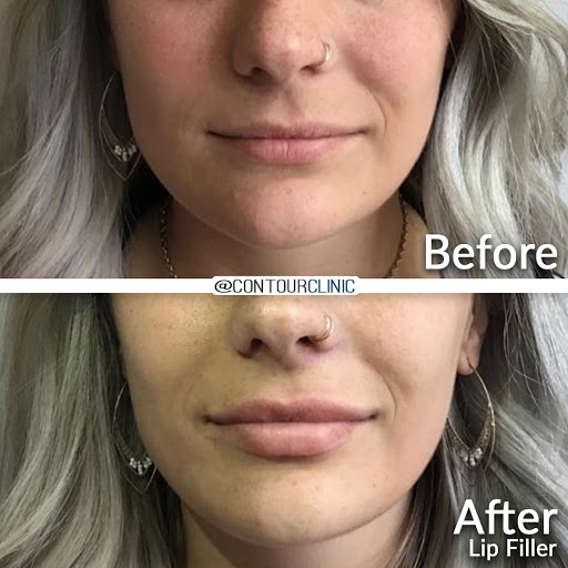 Medical Spa «Contour Clinic | Vadnais Heights», reviews and photos, 1058 Centerville Cir, Vadnais Heights, MN 55127, USA