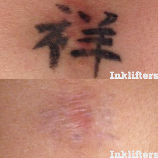 Explore one of one tattoo ideas, creative tattoo ideas in Pleasant Grove, available at Inklifters Tattoo Removal