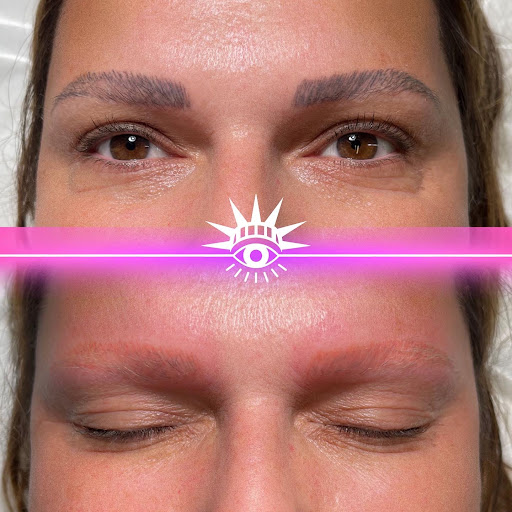 Explore dart tattoo ideas, creative tattoo ideas in New York, available at WOW LASER NYC Tattoo removal in New York