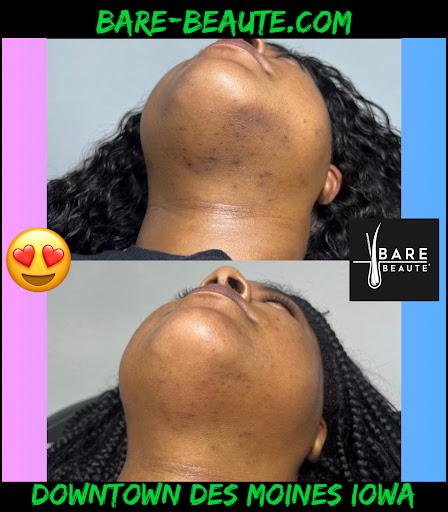 Explore cute animal tattoo ideas, creative tattoo ideas in Des Moines, available at Bare Beaute Permanent Hair Removal By Electrolysis, LLC