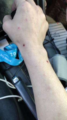 Blood Donation Center «Talecris Plasma Resources», reviews and photos