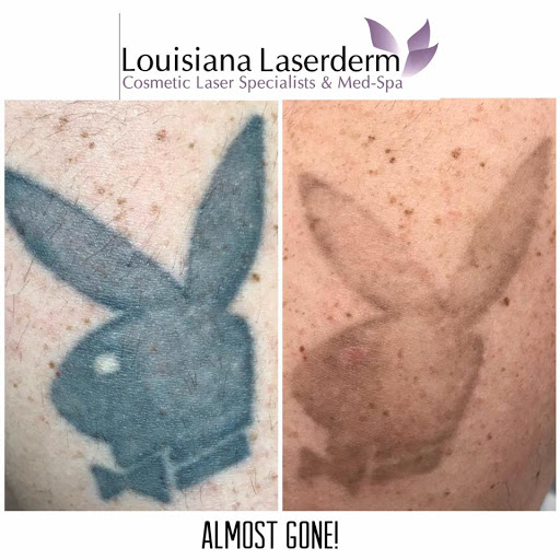 Explore bird family tattoo ideas, creative tattoo ideas in Baton Rouge, available at Louisiana Laserderm