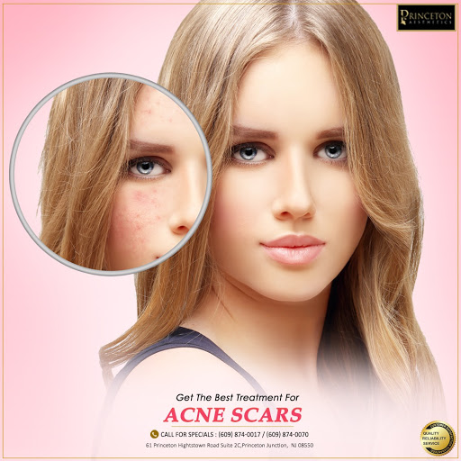 Find cambodian tattoo ideas for your next unique tattoo in Princeton Junction at Princeton Aesthetics