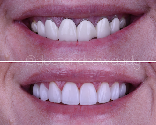 Carlsbad Beach Dental - Drew Addy, DDS image