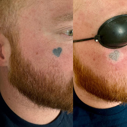 Explore itachi tattoo ideas, creative tattoo ideas in Savannah, available at Haute Brows. Cosmetic Tattoo