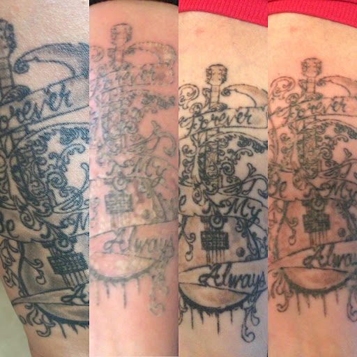 Explore davinci tattoo ideas, creative tattoo ideas in Morrisville, available at Regerts Ink Removal