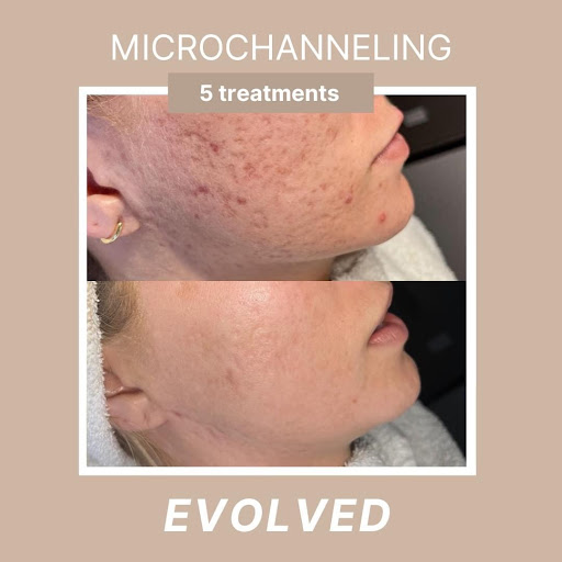 Explore tattoo ideas unicorn, creative tattoo ideas in Savannah, available at Haute Brows. Cosmetic Tattoo